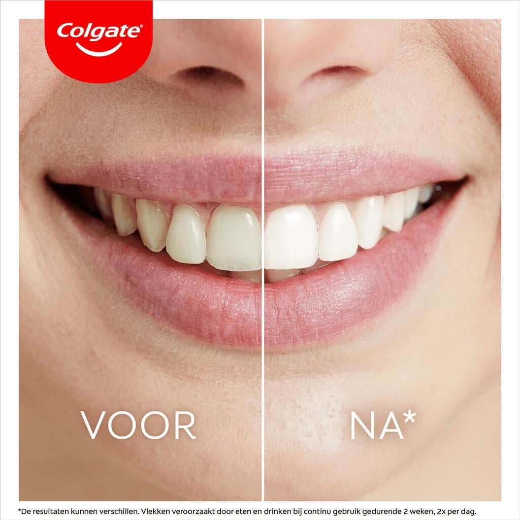 Colgate Max White Ultimate LED-Zahnaufhellungsset – Verpackung beschädigt