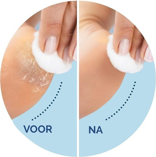 Scholl Velvet Smooth - Navulling Eeltverwijderaar - Extra Fijn - Voetvijl - 2 Stuks